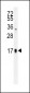 FSH-alpha Antibody (C-term)